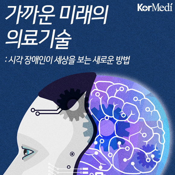 당신의 미래가 사이보그라면?