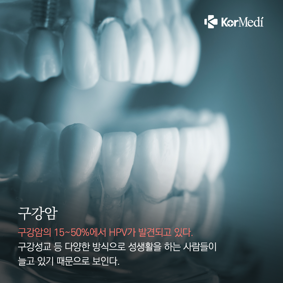 0311_코메디닷컴_성관계가_위험요인이_될_수_있는_암_7가지_04