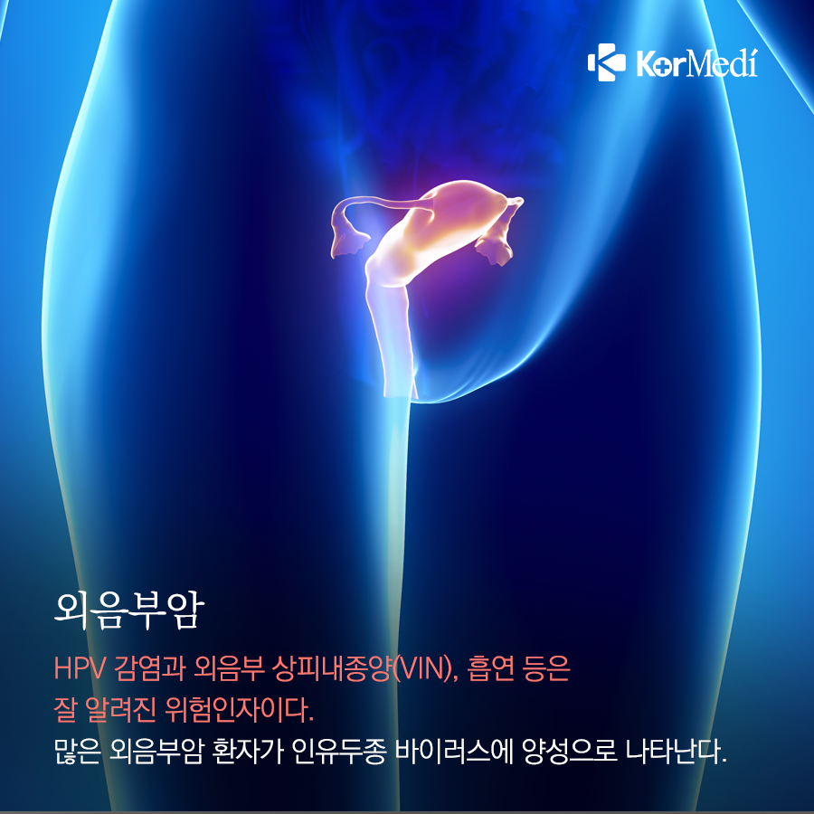 0311_코메디닷컴_성관계가_위험요인이_될_수_있는_암_7가지_05