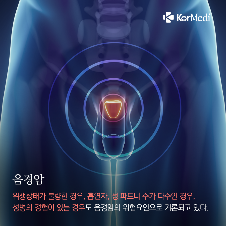 0311_코메디닷컴_성관계가_위험요인이_될_수_있는_암_7가지_06
