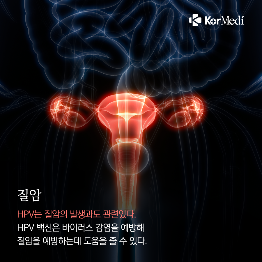 0311_코메디닷컴_성관계가_위험요인이_될_수_있는_암_7가지_08