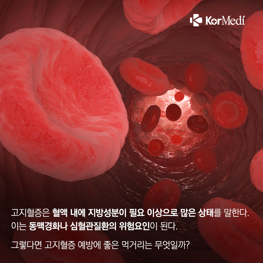 0314_코메디닷컴_고지혈증_예방에_좋은_먹거리_5_02