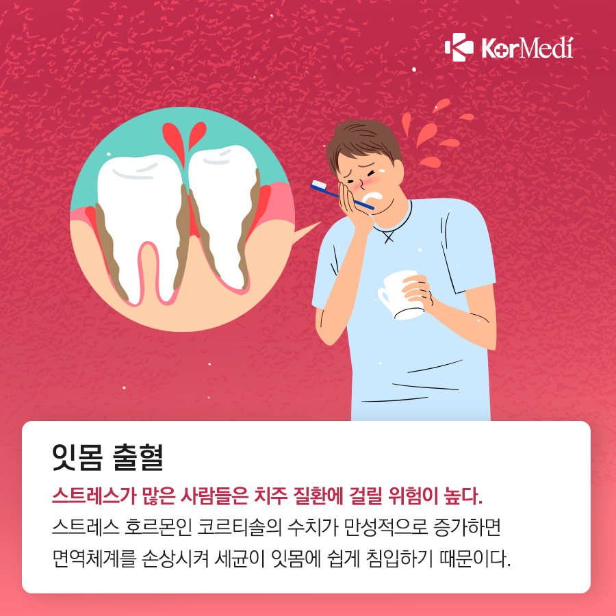 0319_코메디닷컴_스트레스로_인한_묘한_증상_7가지_07