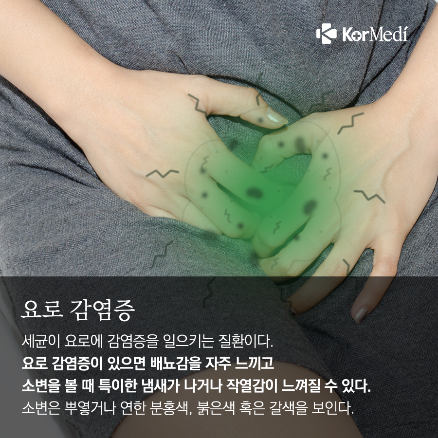 0326_코메디닷컴_아래가-불편한-이유-8_03