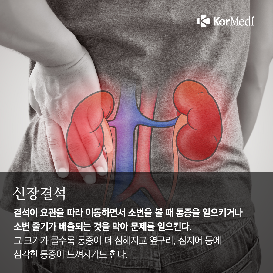0326_코메디닷컴_아래가-불편한-이유-8_06
