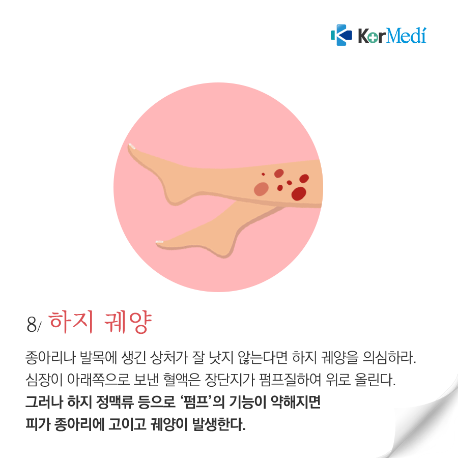 0328_코메디닷컴_상처가_낫지_않는_8가지_이유_10