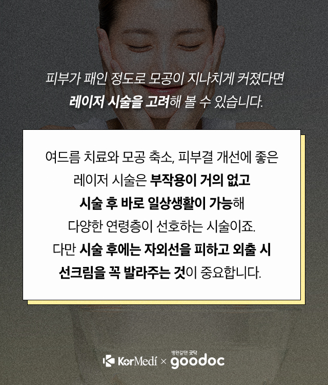 모공-세안법_06