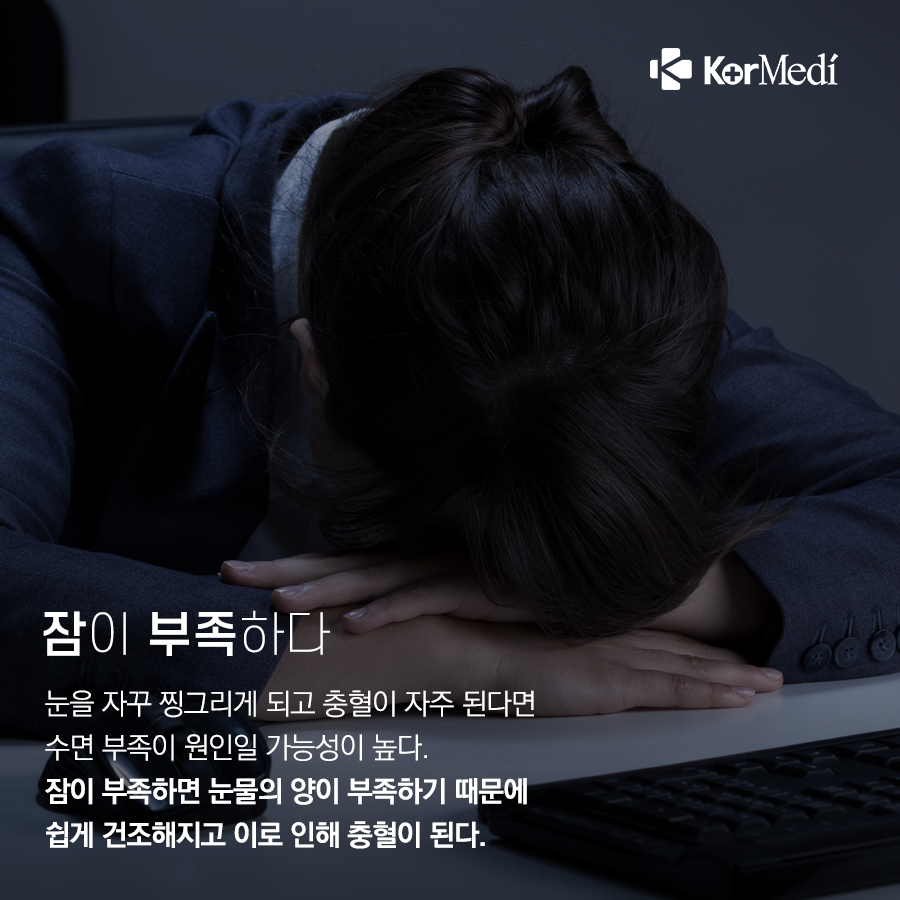 0401_코메디닷컴_충혈-개선-방법-4_03