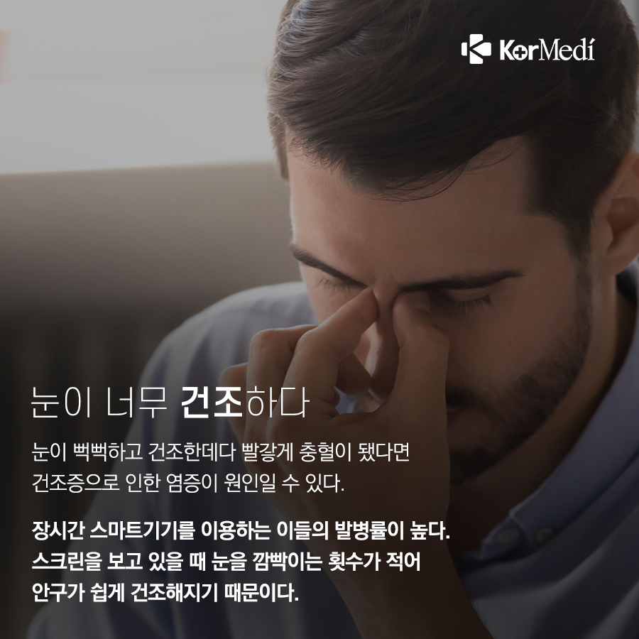 0401_코메디닷컴_충혈-개선-방법-4_05