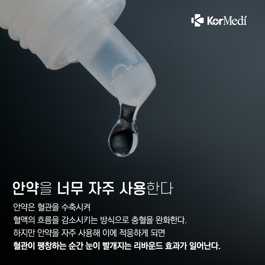 0401_코메디닷컴_충혈-개선-방법-4_07