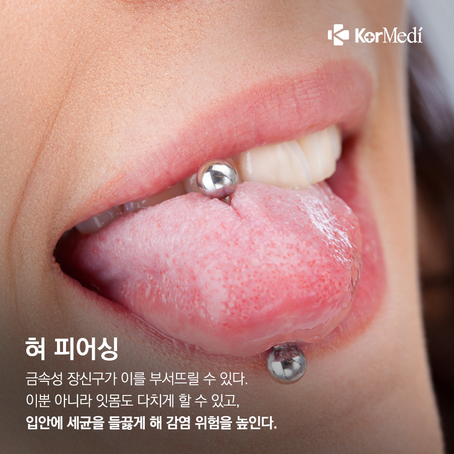 0408_코메디닷컴_치아에_독_되는_뜻밖의_행동_8가지_06