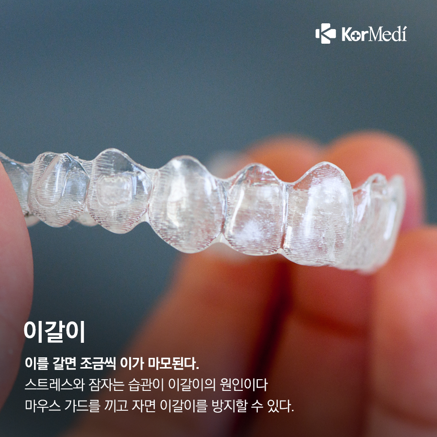 0408_코메디닷컴_치아에_독_되는_뜻밖의_행동_8가지_07