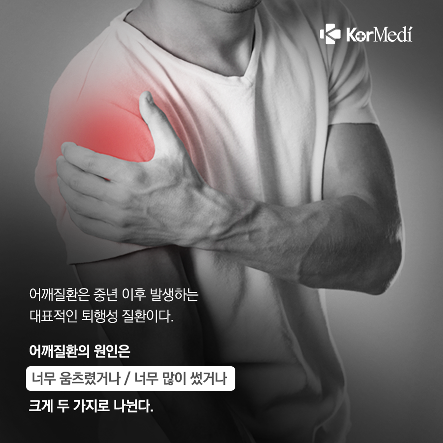 0409_코메디닷컴_중년들_괴롭히는_어깨질환_3가지_02
