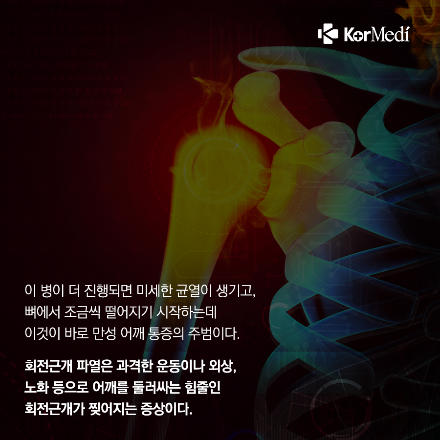 0409_코메디닷컴_중년들_괴롭히는_어깨질환_3가지_07