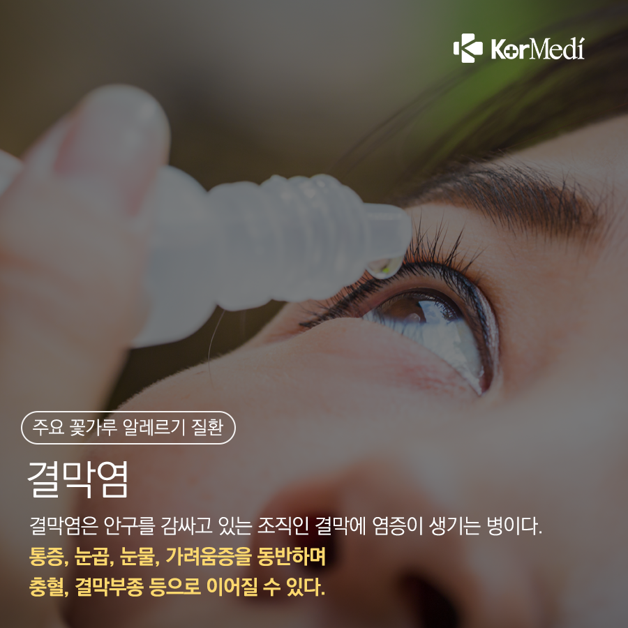 0415_코메디닷컴_꽃가루_농도_위험지수를_아시나요_05