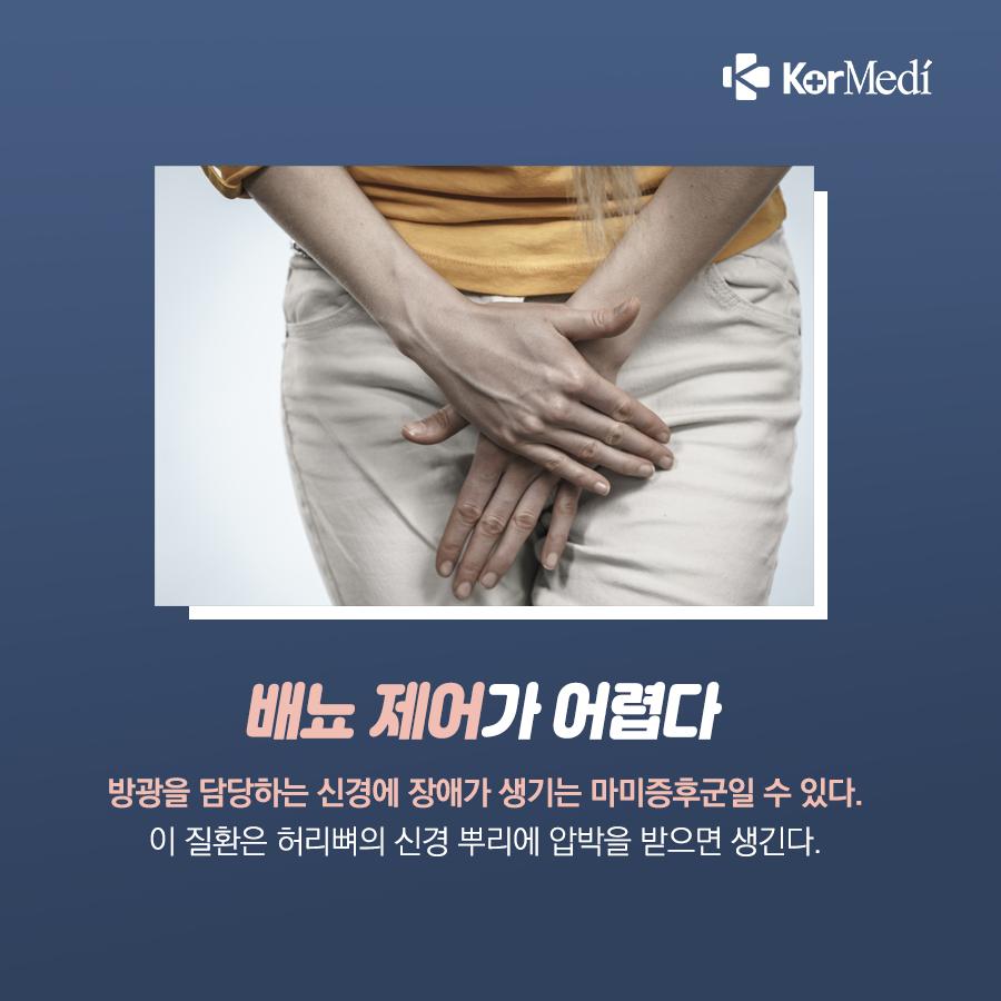 0417_코메디닷컴_무시하면_큰일_나는_허리_통증_증상_04