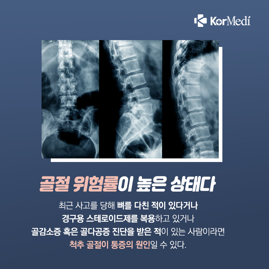 0417_코메디닷컴_무시하면_큰일_나는_허리_통증_증상_07