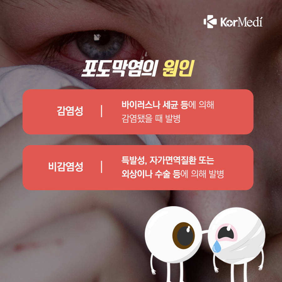 0423_코메디닷컴_결막염인_줄…실명_가능한_‘포도막염’_03
