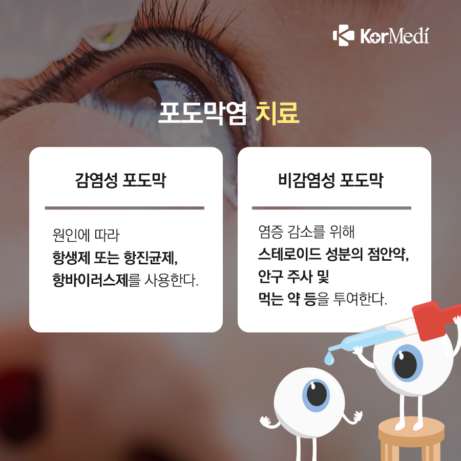 0423_코메디닷컴_결막염인_줄…실명_가능한_‘포도막염’_06
