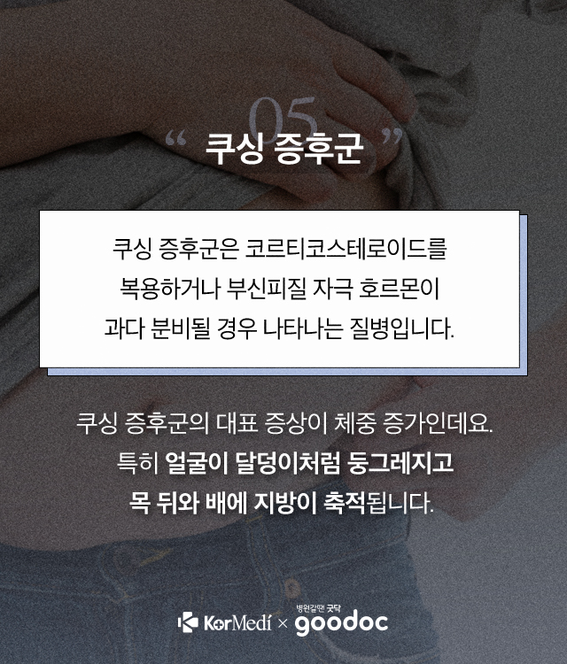 복부_05