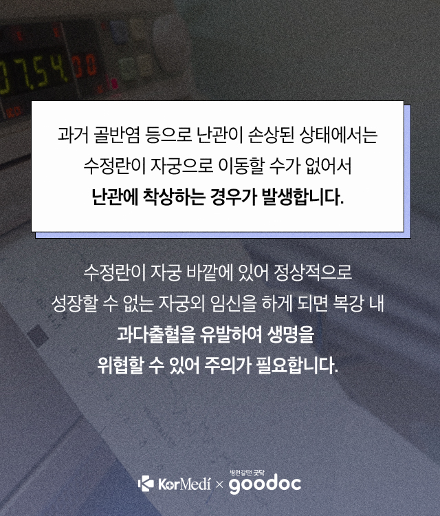 자궁외-임신_04