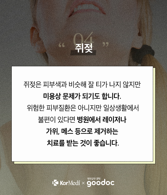 피부트러블_05