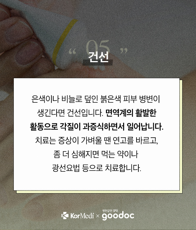 피부트러블_06
