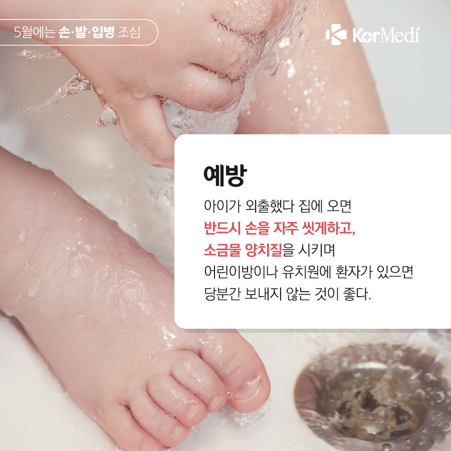 0502_코메디닷컴_5월엔_아이들_손·발·입병_조심_06