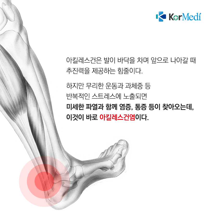 0514_코메디닷컴_아킬레스건염_02