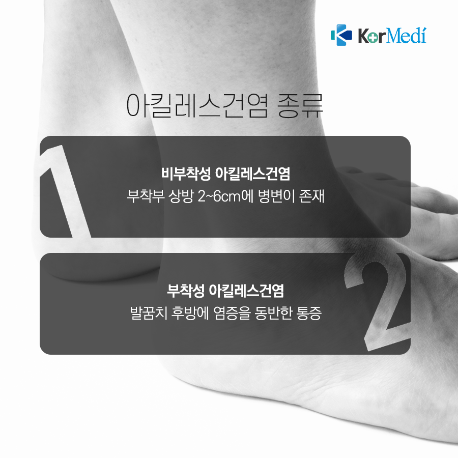 0514_코메디닷컴_아킬레스건염_03