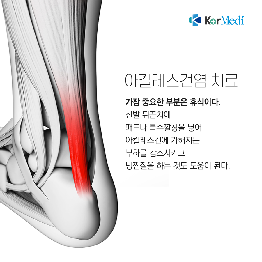0514_코메디닷컴_아킬레스건염_07