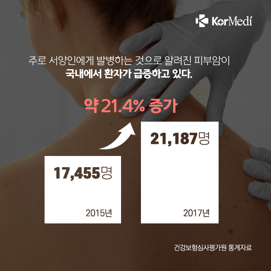 0516_코메디닷컴_점인가_했는데_피부암_02