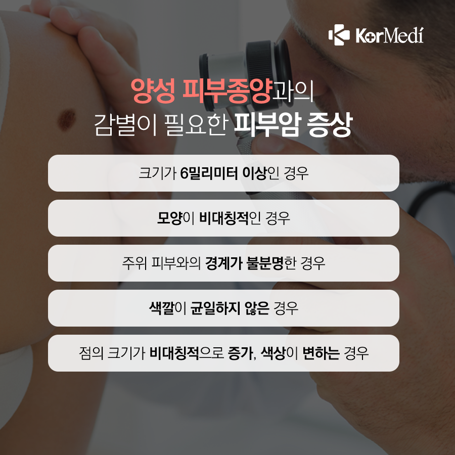 0516_코메디닷컴_점인가_했는데_피부암_04