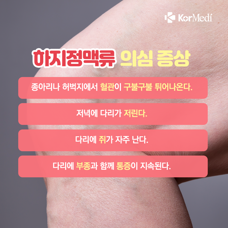 0524_코메디닷컴_하지정맥류_03