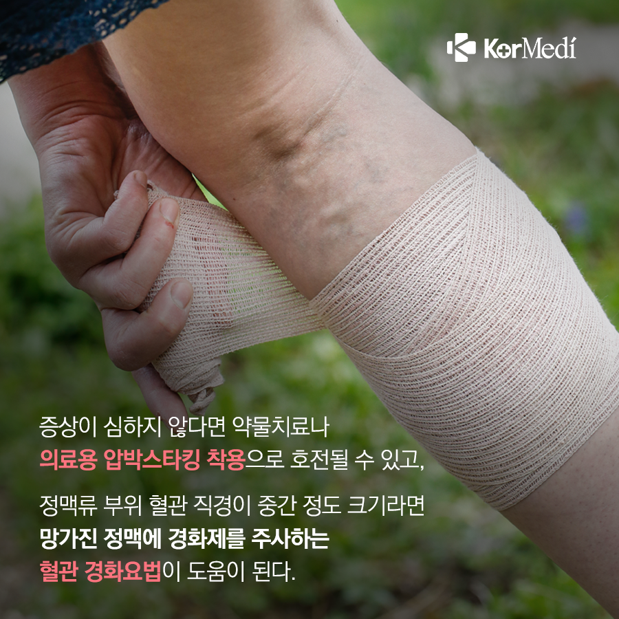 0524_코메디닷컴_하지정맥류_06
