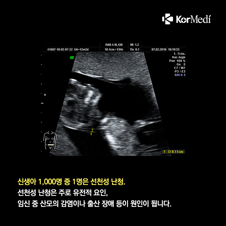 0928_코메디닷컴_난청_생애_언제든_나타날_수_있어요_02