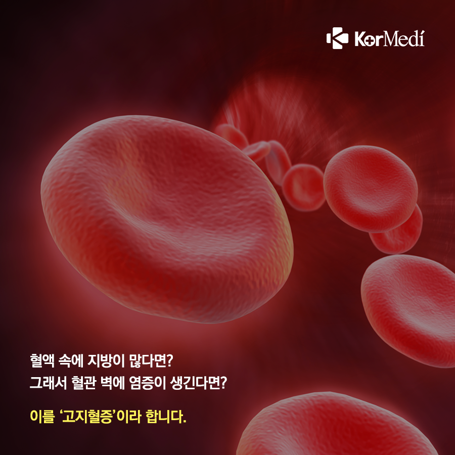 1031_코메디닷컴_고지혈증_예방하려면_비만_관리부터_02
