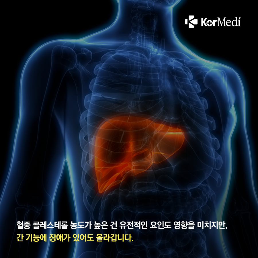 1031_코메디닷컴_고지혈증_예방하려면_비만_관리부터_04