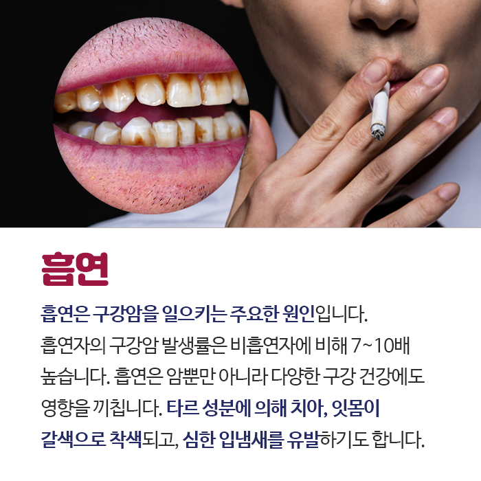 대지-7