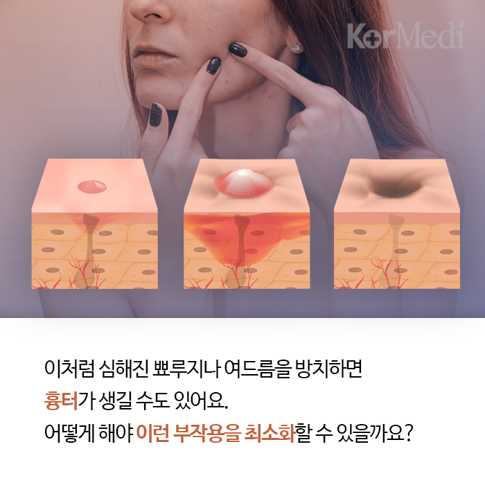 artboard-52