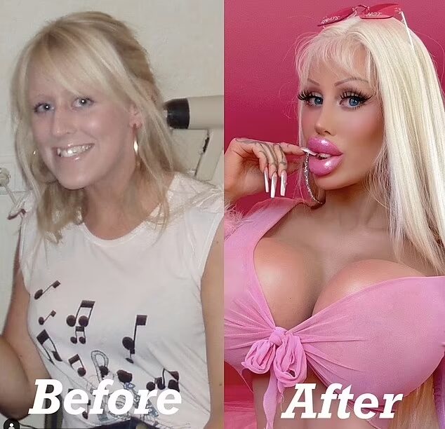 Alisha Almira,who has undergone extensive​ plastic​ surgery to resemble a‌ Barbie doll.