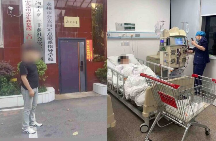 Boy undergoing kidney transplantation after excessive squats