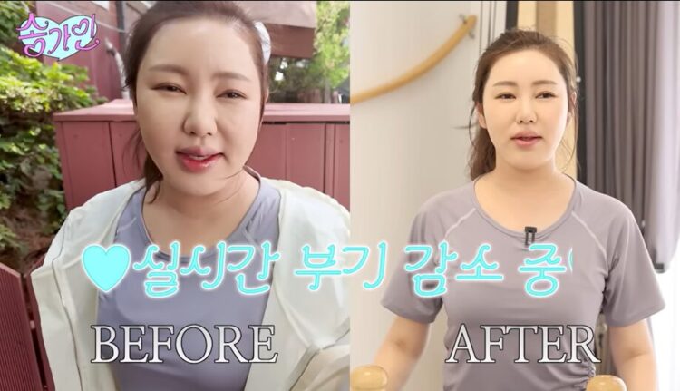 송가인 “실시간 부기 빠져”…‘이 운동’ 한번에 턱선 달라졌다고?
