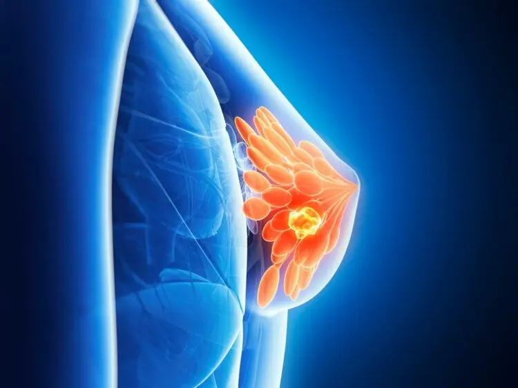 젊다고 안심 못하는 유방암·갑상선암…조기 발견과 원스톱 진료가 관건