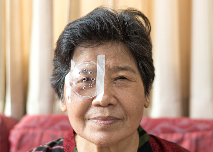 Woman after cataract surgery