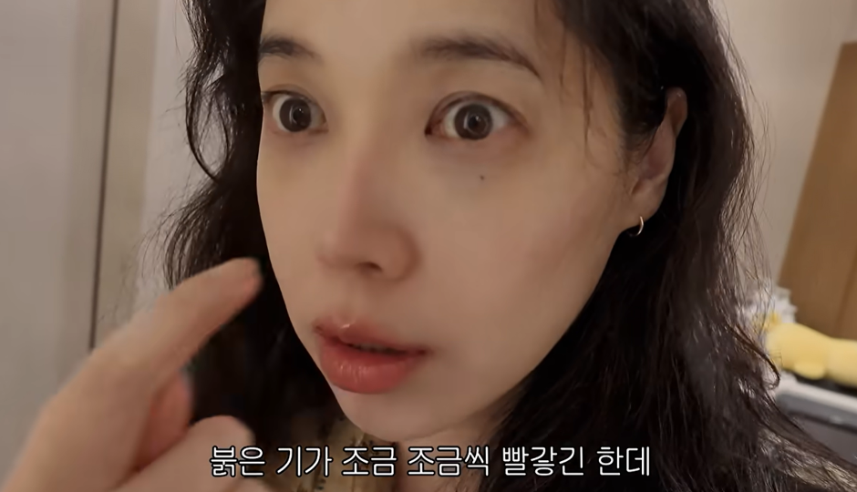 “벌써 피부 좋아진 느낌” 배다해, ‘줄기세포’ 시술 받았다는데…어떤 효과?